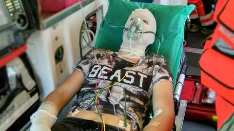 Przygotowywał pokaz chemiczny. 17-latek ma poparzone ręce i twarz