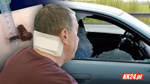 Przejeżdżał obok strzelnicy, został ranny w szyję. Sprawę bada policja