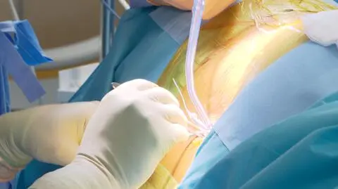 "Chcę jeden dzień zasnąć bez bólu, spać bez bólu, obudzić się bez bólu"