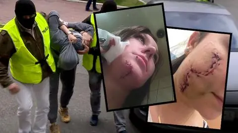 Miał okaleczyć młode kobiety "tulipanem". Zarzut usiłowania zabójstwa