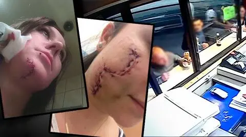 Kobiety brutalnie zaatakowane w centrum Katowic. Same szukają sprawcę