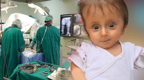 Ma dwa lata, a waży trochę więcej niż noworodek