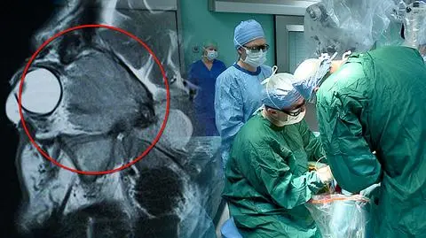 Innowacyjna operacja na Mazowszu. Lekarz w okularach 3D ratuje wzrok pacjenta