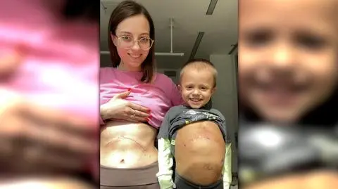 Przeszczep wątroby w Centrum Zdrowia Dziecka