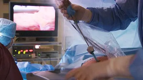 Chemioterapia w aerozolu