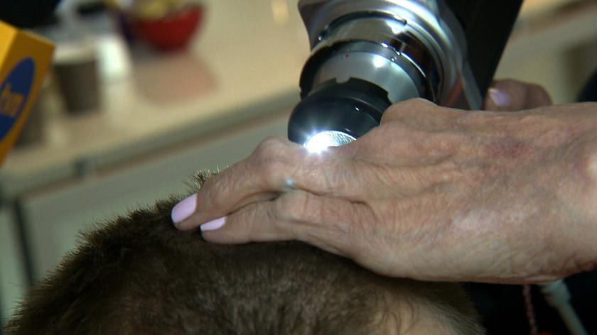 17.03.2018 | Trichoskopia ratunkiem dla włosów. Ta metoda może zahamować łysienie