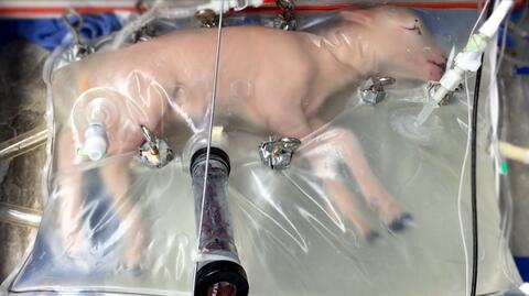 27.04.2017 | Amerykanie testują sztuczną macicę. Na razie na jagniętach