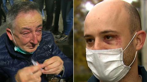 Poseł i aktywista wśród rannych po atakach na uczestników protestów