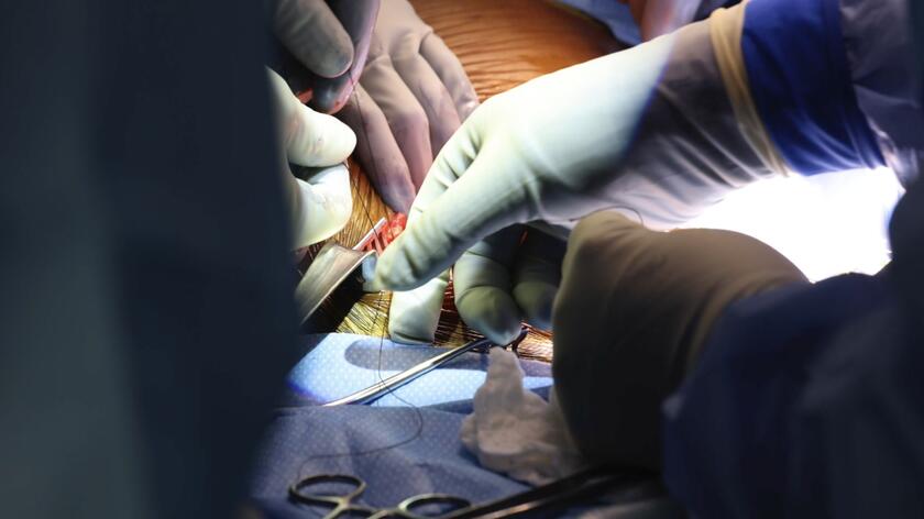 This could be a breakthrough in transplantology.  The first such transplant in the world
