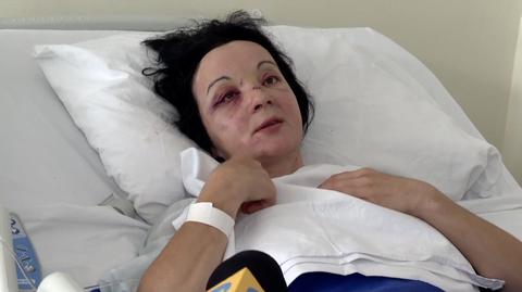 07.08.2022 | Wypadek autokaru w Chorwacji. Stan rannych nie pogarsza się