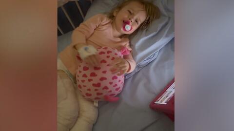 Dwulatka trafiła do szpitala z 19-procentowym poparzeniem ciała. Nie wiadomo, jak się poparzyła