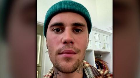 11.06.2022 | Justin Bieber cierpi na zespół Ramsaya Hunta. Wokalista odwołał najbliższe koncerty